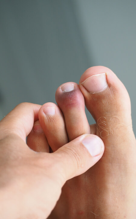 Checking feet for fungus